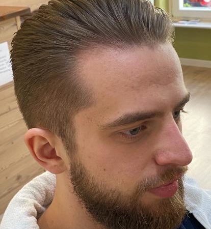 Nachher1
